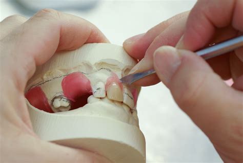 how fake teeth are made
